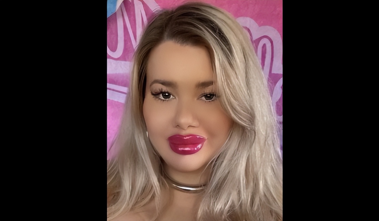 英国女人整容变成卡通人物,英国模特花34万整容