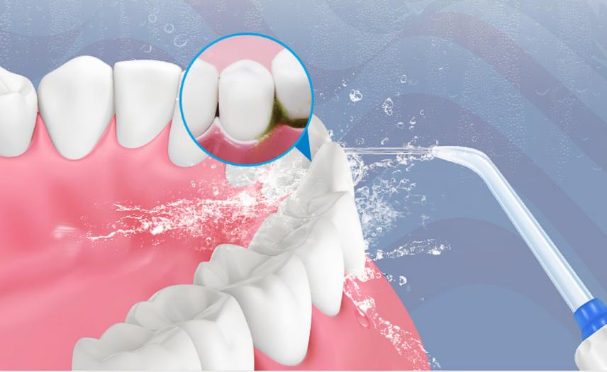 【AISR爱至情报所】假牙吃东西有风险，烤瓷牙裂了该怎么办？