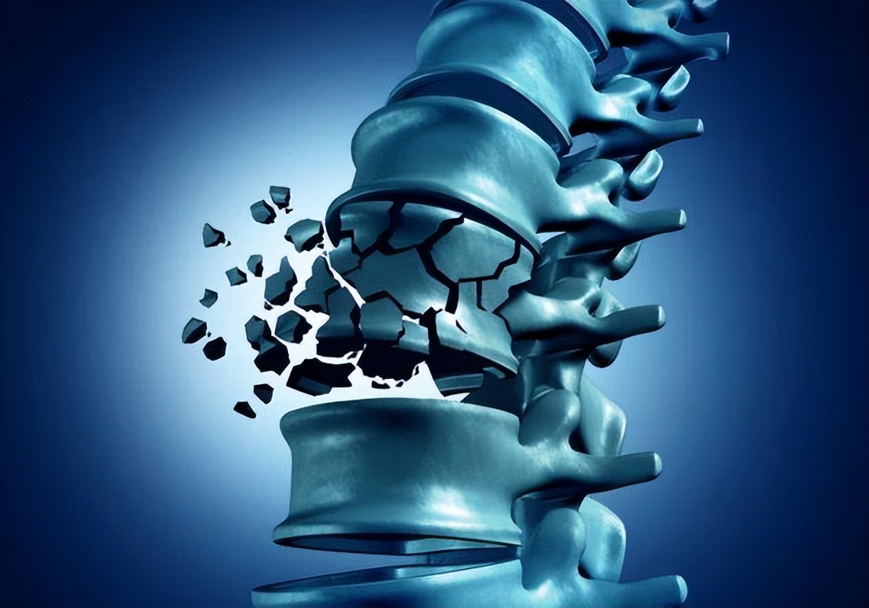 吃含钙高的食物和钙片哪个好,吃含钙高的食物不吃钙片行不