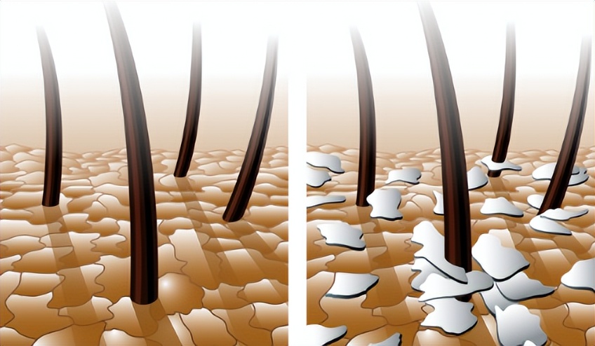头皮上长红疙瘩脓包涂什么药膏,头皮上长红疙瘩脓包用什么药