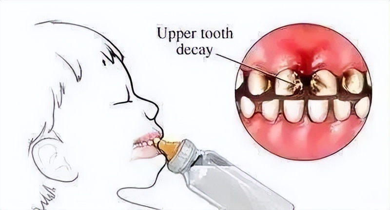 怎么样让孩子摆脱奶瓶,如何有效帮助孩子戒掉奶瓶