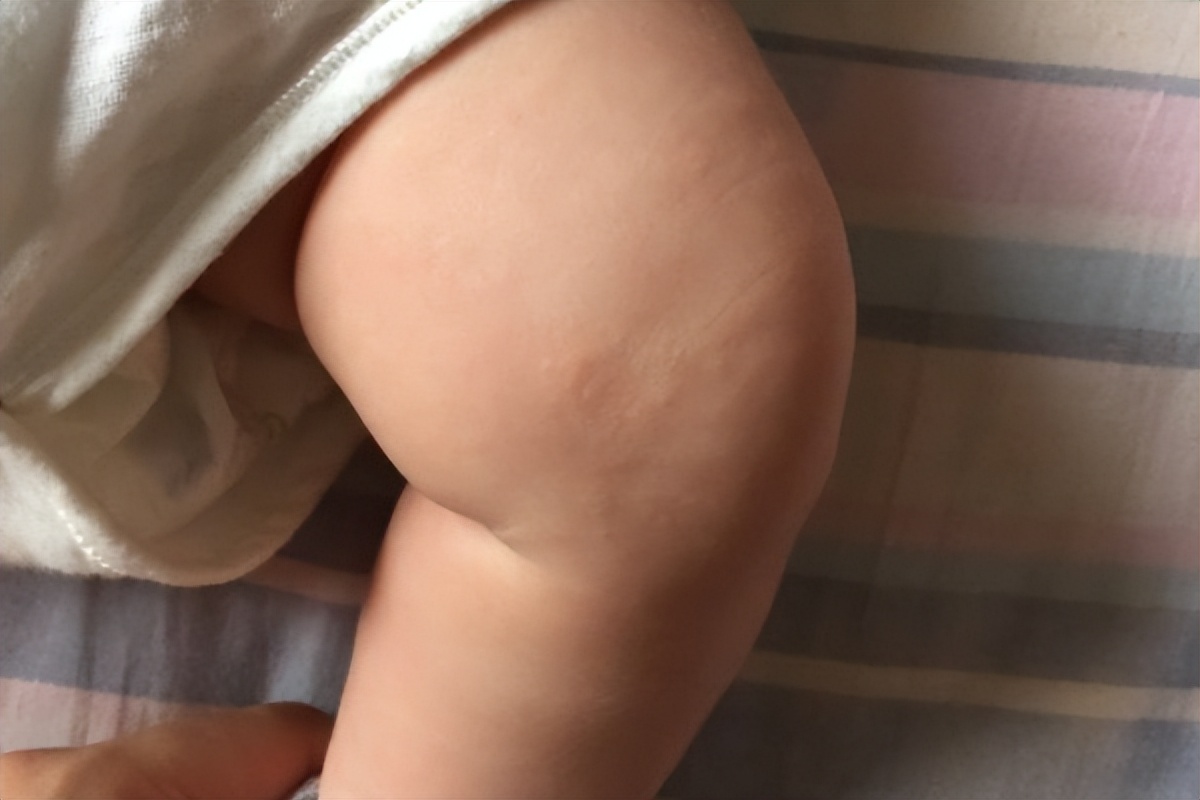 父母都不是o型腿孩子会是吗,家长有o型腿会遗传给宝宝不