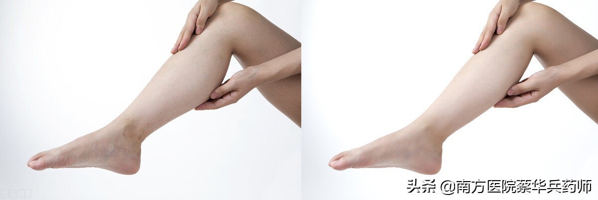 中医彻底根治水肿的方法,水肿的中医西医治疗方法对比