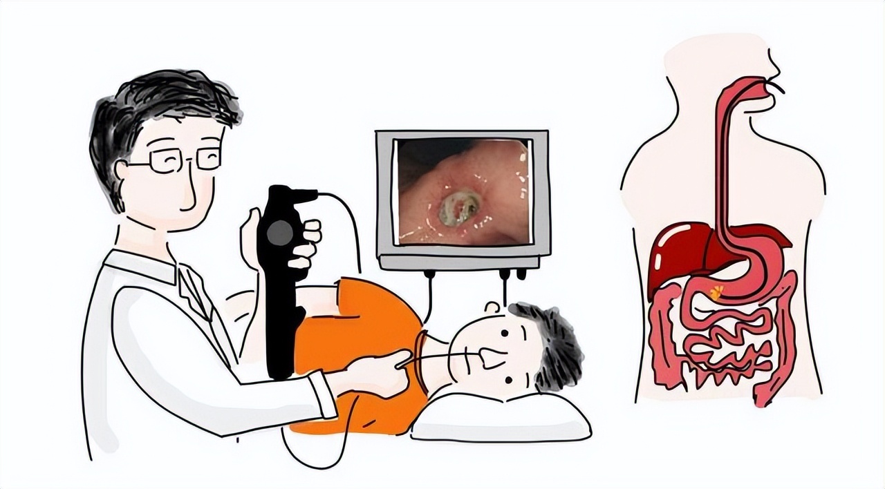 普通胃镜和无痛胃镜的区别是什么,无痛胃镜与普通胃镜有什么区别