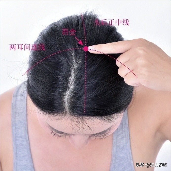 阳康之后头痛怎么办,阳康之后一直头疼是怎么回事