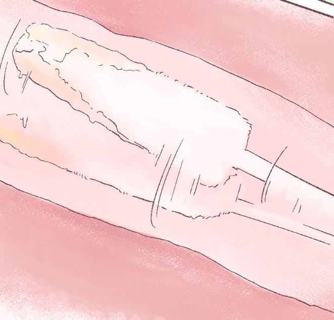 “正经女生哪会得妇科病？”快闭嘴吧你