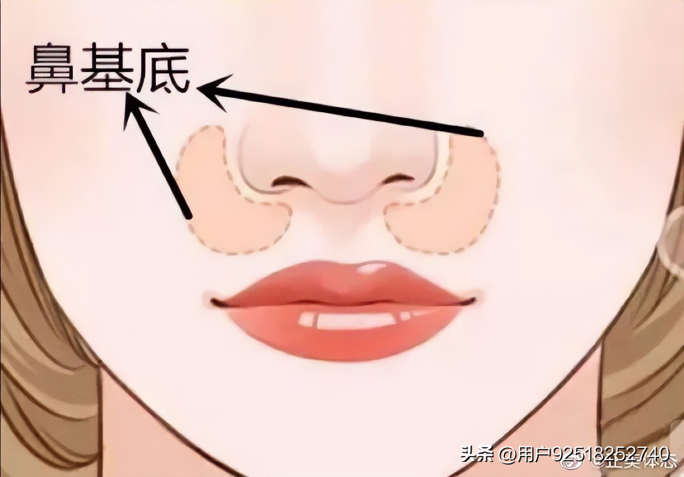 法令纹鼻基底深怎么改善,怎么判断法令纹是鼻基底凹陷