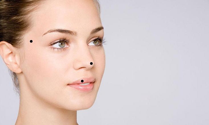 警惕这些痣可能会成瘤,哪些地方有痣代表得癌症了