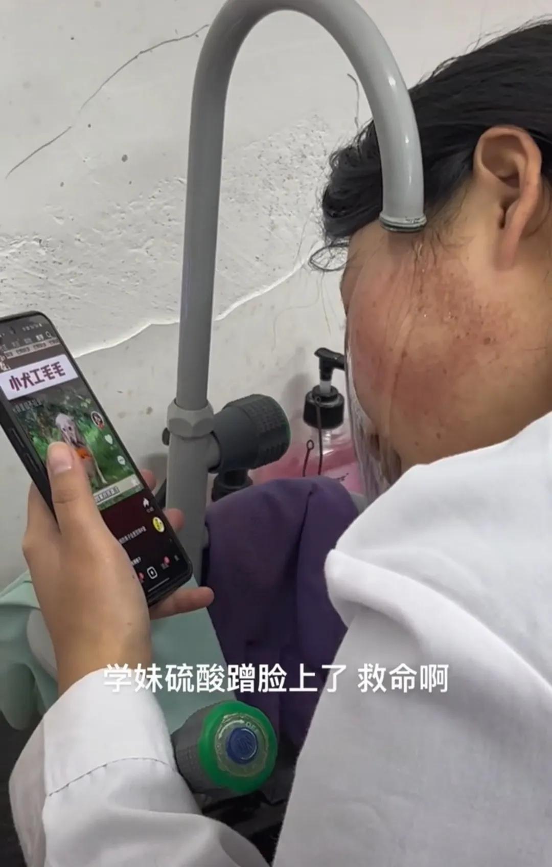 硫酸溅到脸上直接拿水冲可以吗,硫酸泼到脸上可以恢复吗