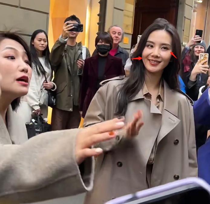 整容失败的女星蛇精脸,女星整容失败脸歪嘴斜