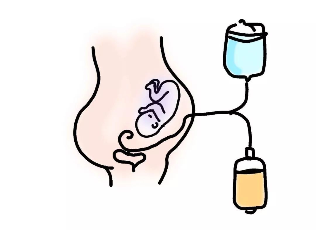 重度子痫前期母亲,重度子痫前期会引发心衰吗