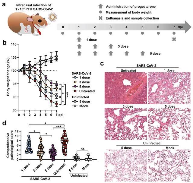 研究揭示女性感染新冠后症状更轻的原因：性激素黄体酮起重要作用