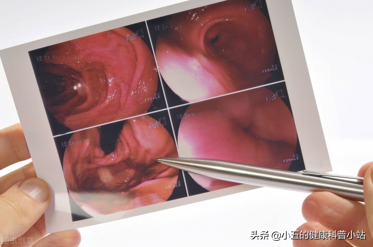 喝酒突然吐血紧急抢救,吃饭时无缘无故吐血