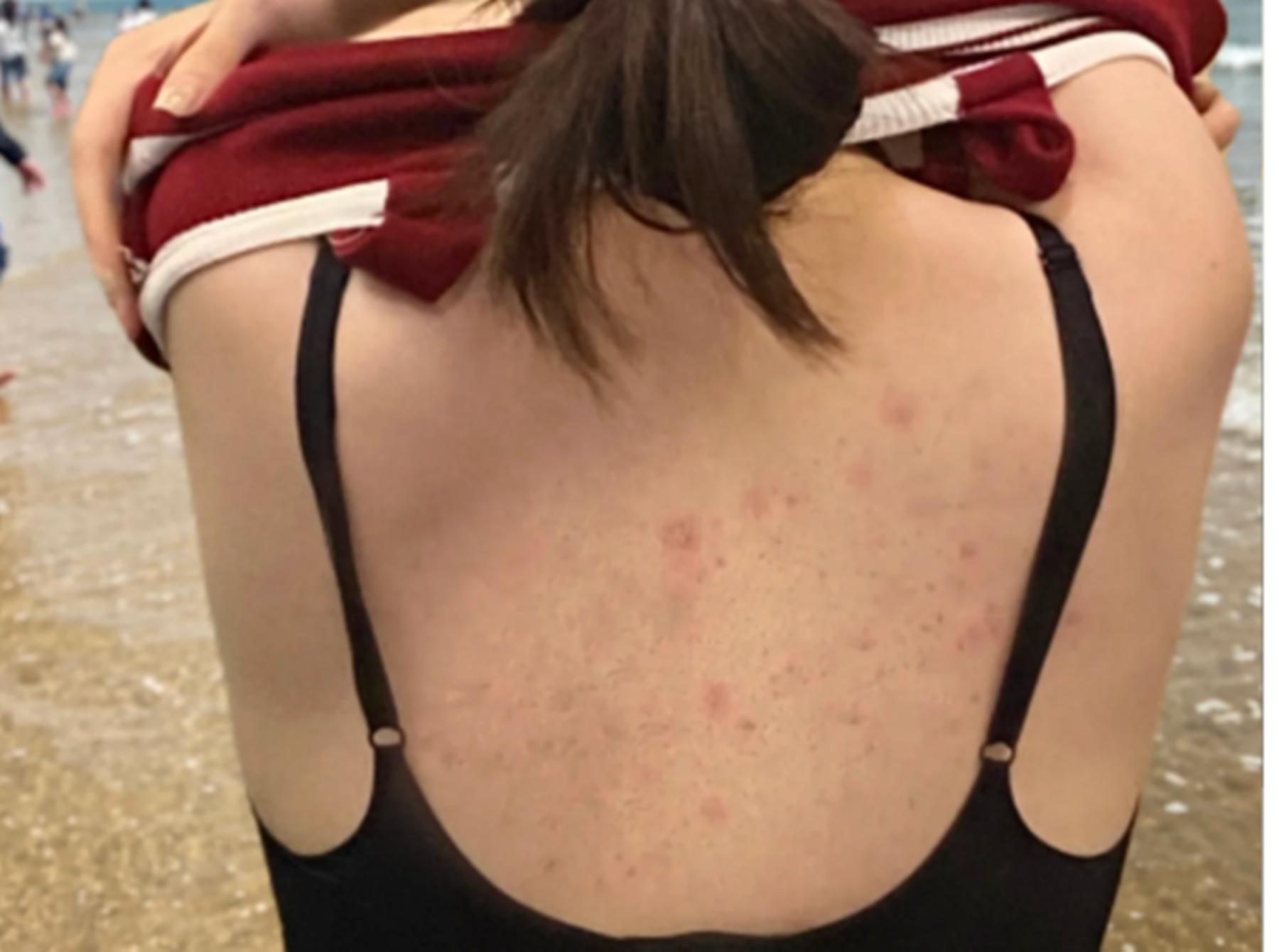 自用沐浴露测评！选对立马告别粗糙后背！顽固痘痘洗洗秒断根！