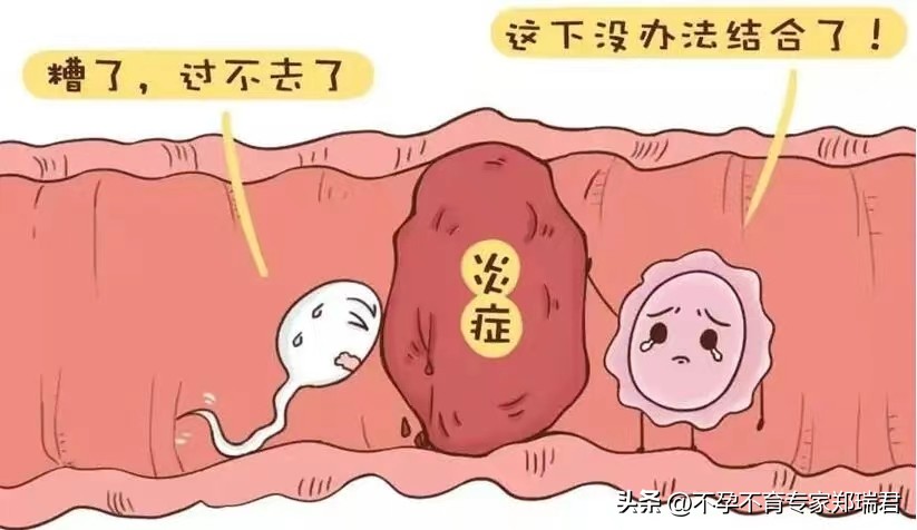 输卵管不通，成功治愈并怀孕