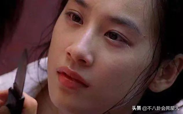 单眼斜视的明星,三白斗鸡眼