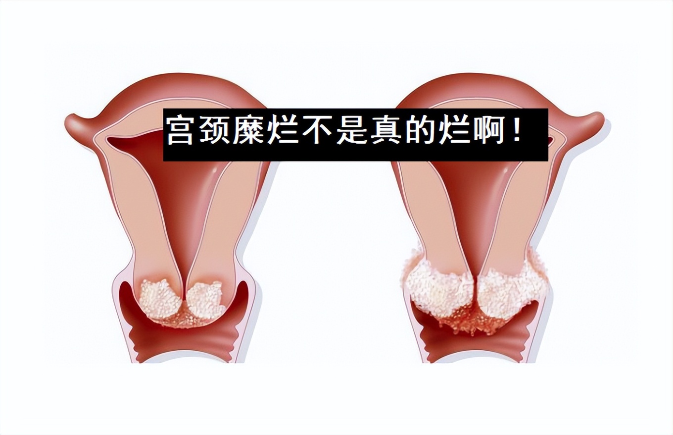 女子下身检查疼痛难忍,女孩腹痛到医院检查惊呆了