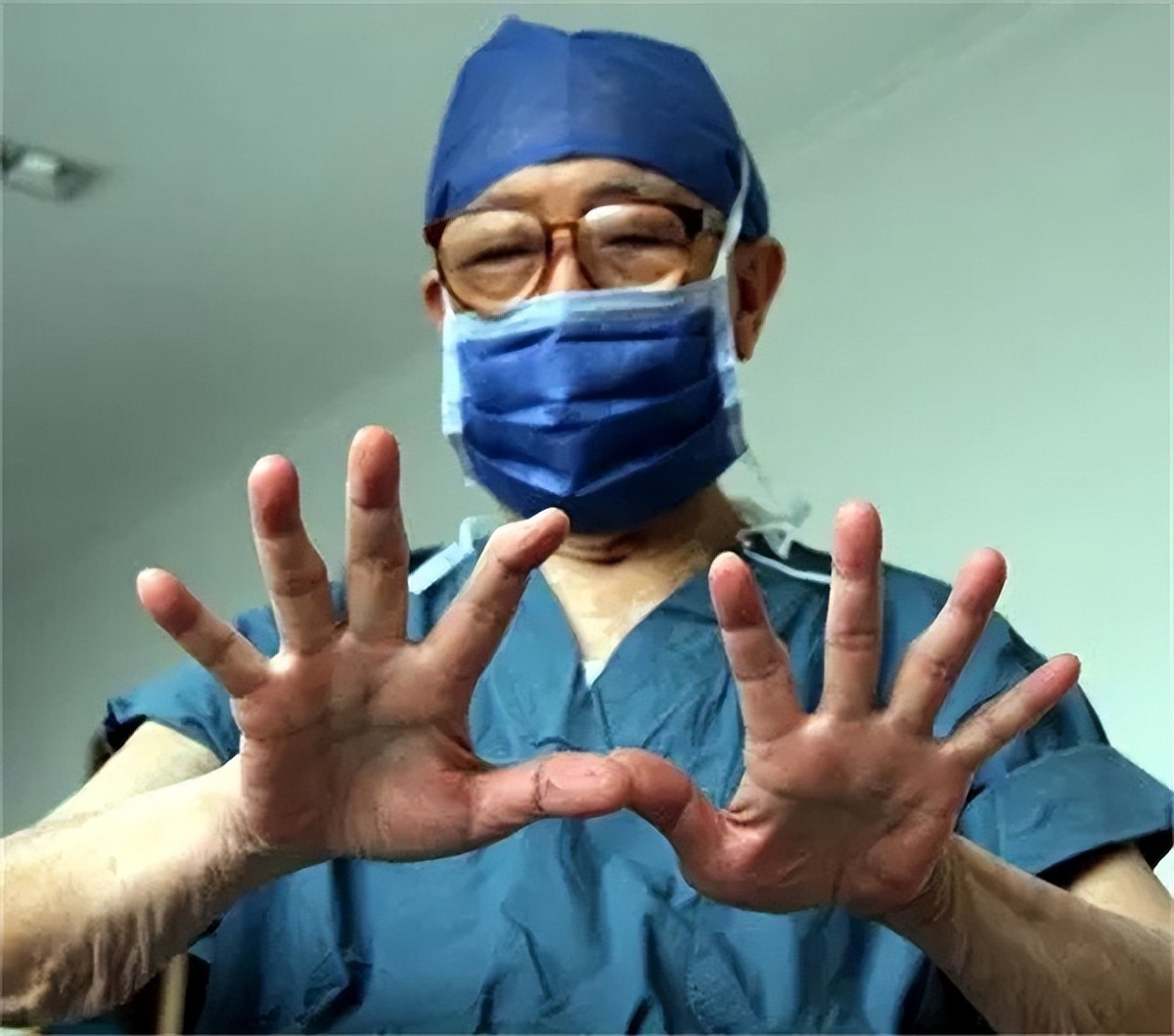 吴孟超中科院院士,吴孟超院士的养肝原则