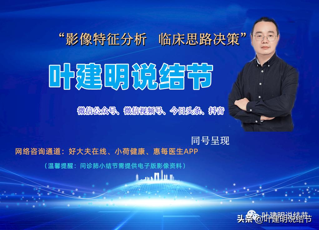 右下叶磨玻璃6mm结节基本上是癌,右下叶少许炎症上叶磨玻璃结节