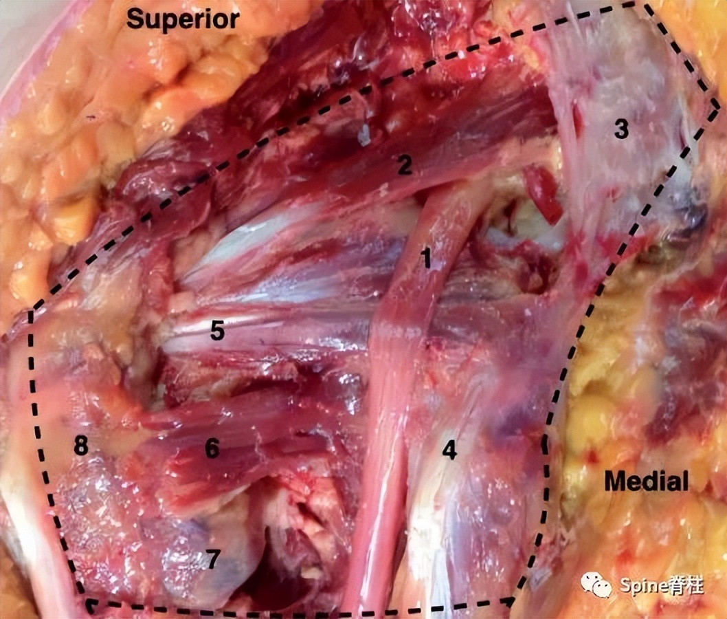 针灸治疗梨状肌综合征,一文了解贲门失弛缓症