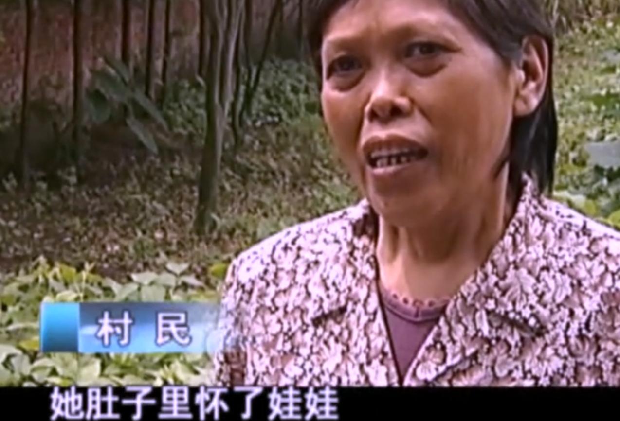 2007年四川90岁老妇，腹中怀子60年未生，后检查发现胎儿没有腐烂