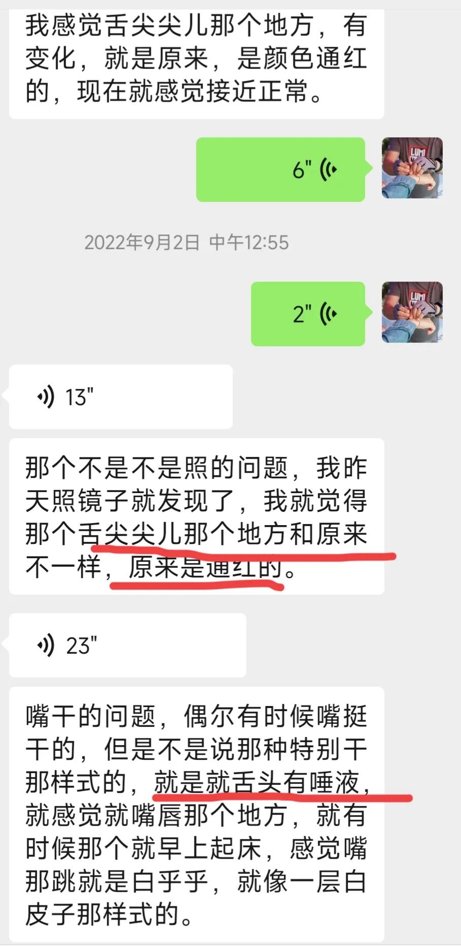 干燥综合征吃中药多久可以控制,干燥综合征喝中药可以治愈吗