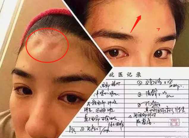 被抑郁症骗婚,患抑郁症被人骗