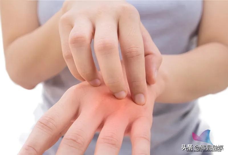 为啥身上痒痒,冬季身上干痒怎么办越挠越痒