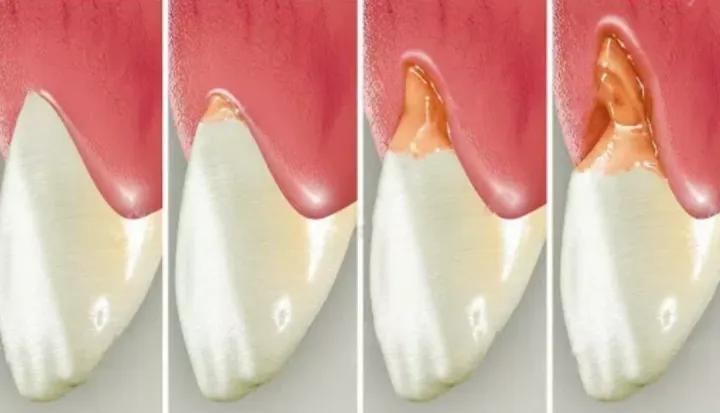 涂氟时候小孩不配合,宝宝2岁涂氟不配合