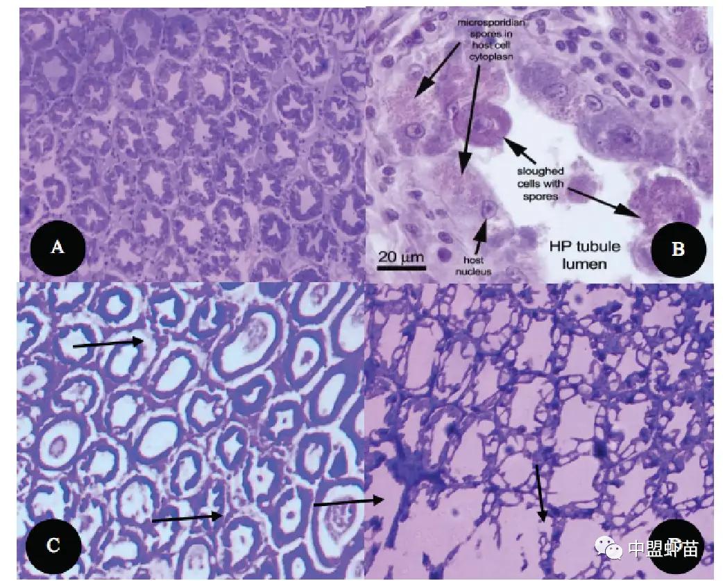 这种虾病，对虾产业产生深远影响！养殖大神揭露该病的今生前世！
