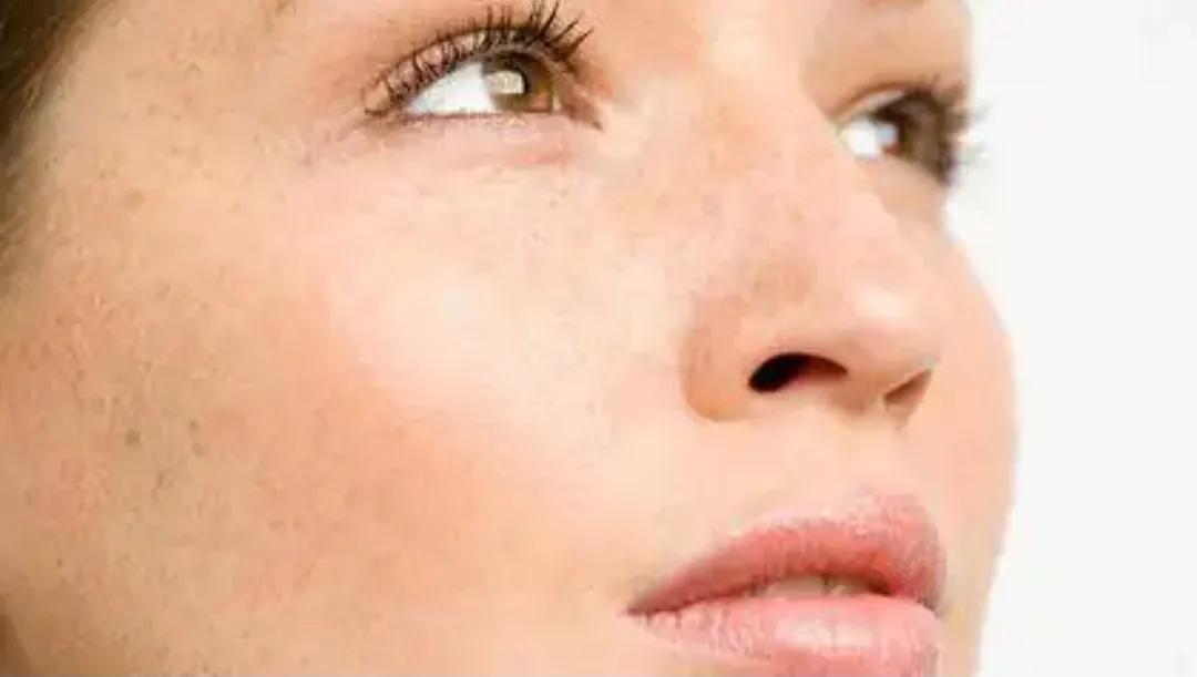 40多岁脸上长黑点是什么斑,40岁脸上长斑用什么护肤品