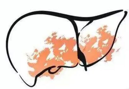 口苦失眠眼花,口苦肝火旺失眠怎么调理