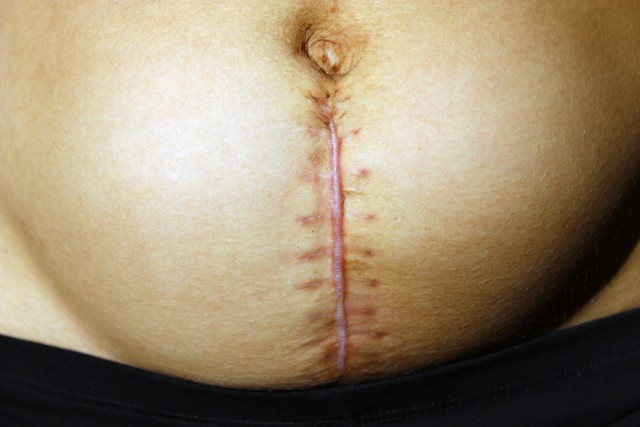 坐月子才知道婆婆就是婆妈,产后才知道婆婆不是妈