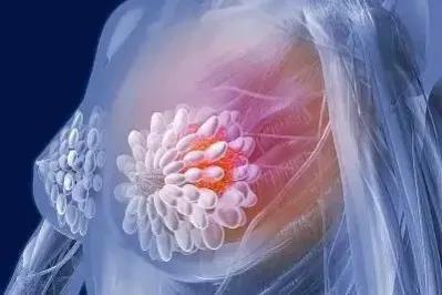 倪海厦讲乳腺结节的处方,张仲景乳腺增生