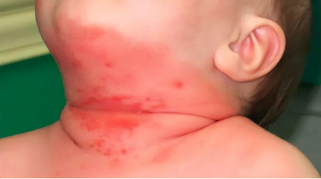 孩子夜间出汗多,是体虚吗?注意:出现这4种情况,可能是真的了