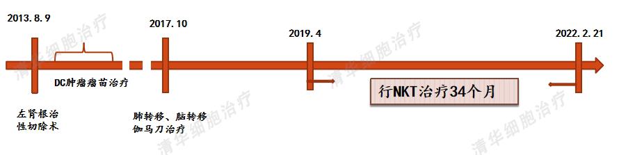 患癌20年经历2次转移最终抗癌成功,肾癌10年后发生转移