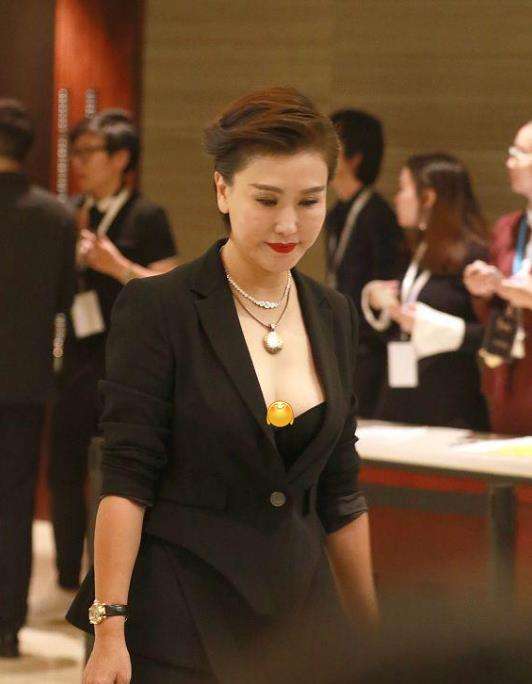 老演员整容脸变形,老年人整容前后照片