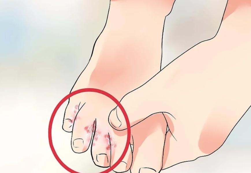 中暑误用藿香正气水,中暑后藿香正气水的正确使用