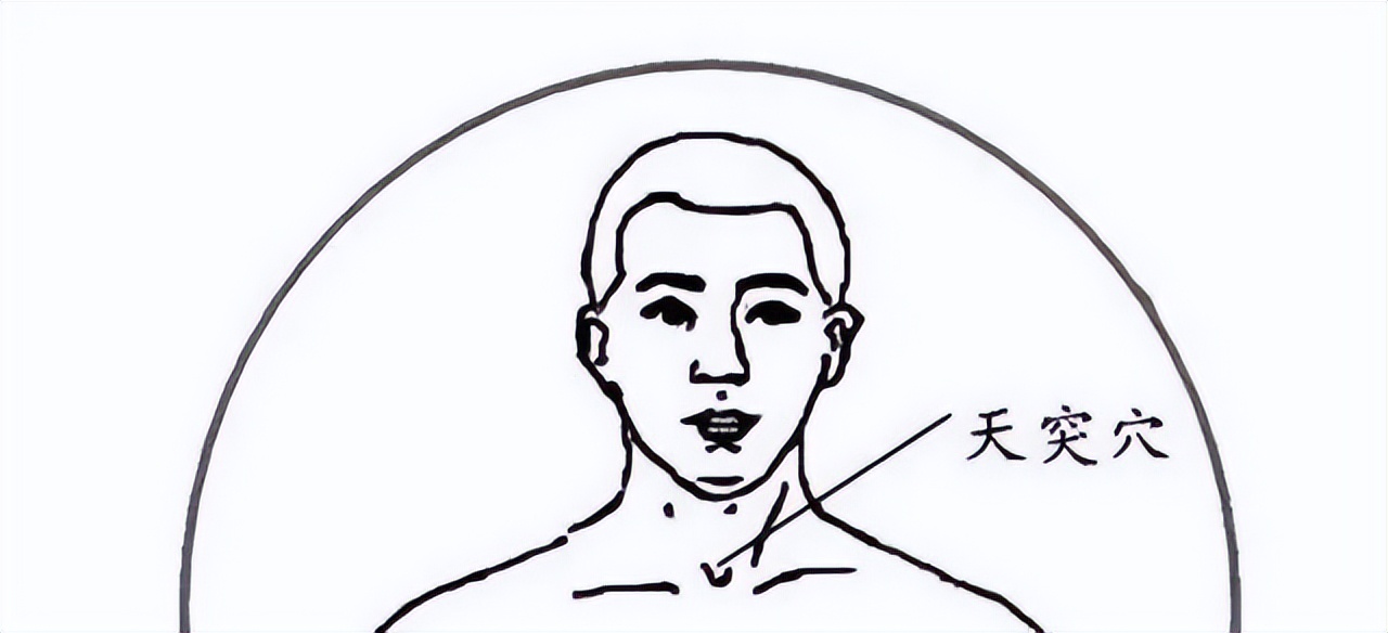 最顽固的痰湿中医化痰名方,痰湿中医调理多久见效