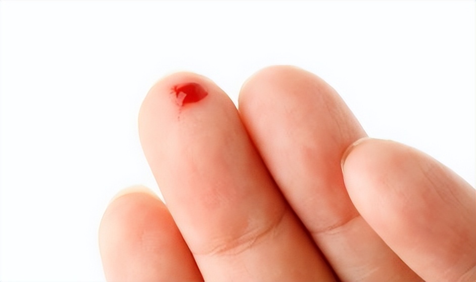 为什么女人小便后,要用纸擦一下呢?医生:很有必要