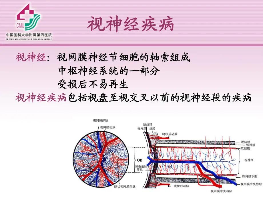 视力下降、视野缺损、色觉异常，什么原因？怎么应对？