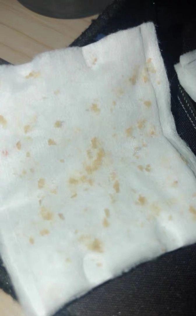 鼻子上有白白的小点可以挤吗,鼻子上黑黑的小点点怎么去除