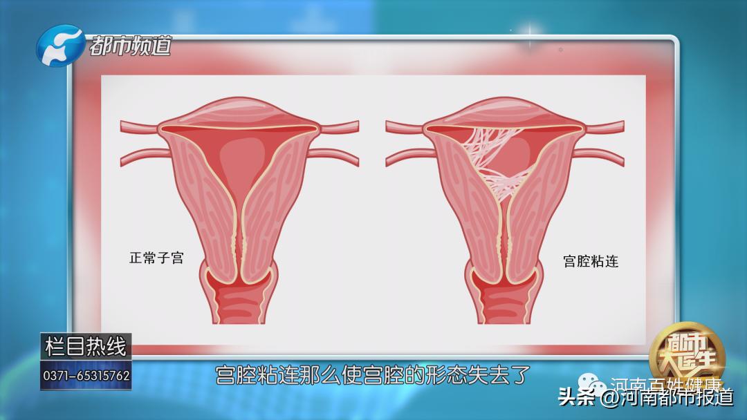 输卵管疾病能治好吗,输卵管有问题好不好治疗