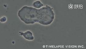 脐带血里存在大量的造血干细胞,脐带血冻存10年