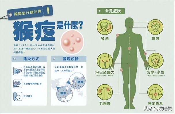 多久可以排除猴痘,面对猴子爆发伤害出不祥还是反甲
