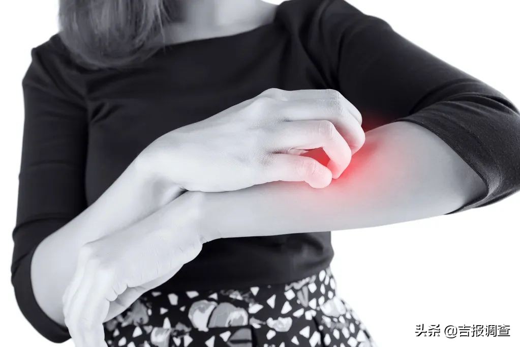 冬季皮肤干燥瘙痒的治疗方法,冬季皮肤干燥起皮屑发痒怎么回事