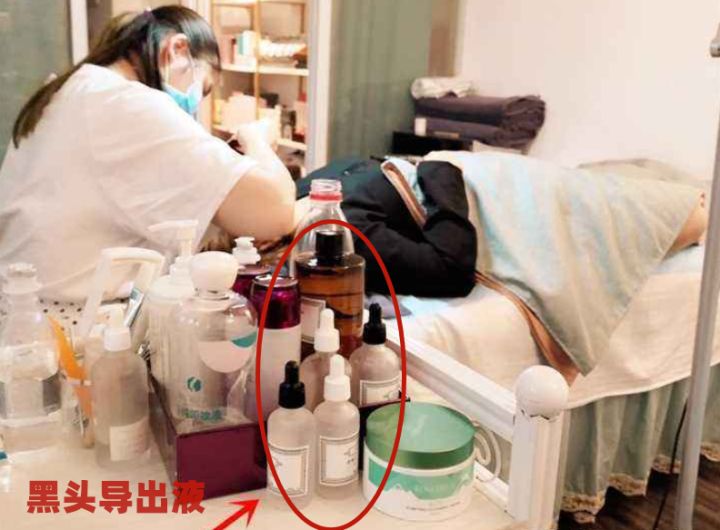 鼻子上有白白的小点可以挤吗,鼻子上黑黑的小点点怎么去除