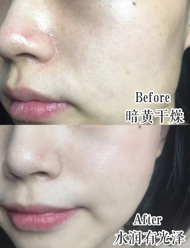 兰蔻菁纯眼精华秒杀,兰蔻菁纯臻颜玫瑰精萃水150ml价格