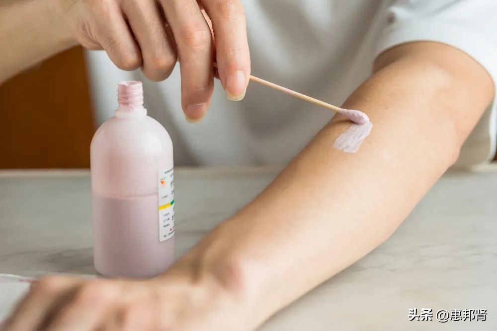 透析病人皮肤瘙痒是否可以多洗澡,透析皮肤痒止痒的办法