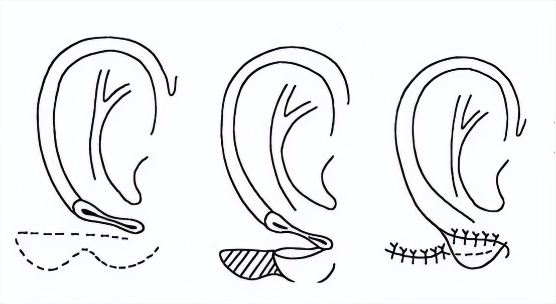 陈国成最近视频,陈国成图片